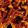 Survival Medicine Hour: Depression, Superbugs, Clint Jivoin of Naked and Afraid Bacteria-rods-241x300-5fbc60674dd0f968981902f79129d9a89d2dad42