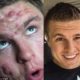 Bodybuilder Credits His Clear Skin To A Vegan Diet And Eating More Vegetables Bodybuilder_ClearSkin-f035fd1e229854726635de860300ba88c3f7b1dd