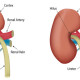 11 Ways to Heal and Prevent Kidney Stones Naturally Blast-Away-Kidney-Stones-Naturally+%281%29-dbab32b9e7e7b70b9d5ca6f1fda63b5a39537ca4