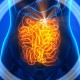 Ways to Prevent and Cure Heartburn 6-Signs-That-SIBO-Might-Be-The-Root-Cause-Of-Your-IBS-770x402-19eaeefd5997123cb5ff7dd35297b5c2051a1970