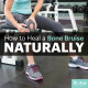 How to Heal a Bone Bruise Naturally 24-Bone-Bruise_Article-Meme-10.21x10.21-b09c044a5dafb7e815bf8731ae304d9b8233796d