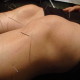 Acupuncture and Arthritis Knee-Acupuncture1-39319b36d304f0bed7e96fac867aa54676be6ee3