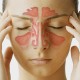 Getting Rid Of A Bad Cold Naturally Curing-Nasal-Congestion-with-Acupressure-Points-bcf7ceab269b8be34e2fd6f926e3fe124ac39870