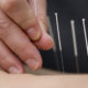 Acupuncture and Endorphins: Not all that Impressive acupuncture-1-7e04046b3b16fed749411cdbf8dae3f12eb6a947