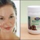 10 Reasons To Start Putting Coconut Oil On Your Face 10-Reasons-To-Start-Putting-Coconut-Oil-On-Your-Face-3ed6a93a859602d0f53b8c3fafd4542cf0267937