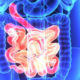 Study: Colonoscopy After 75 May Not Be Worth It colon11251-26afca29e4f062a8d074c9f83683ff9bd90eb91c
