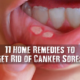 11 Home Remedies to Get Rid of Canker Sores canker-sore-remedies-07946f5edacf1e94754d3c70537bd0621be52760